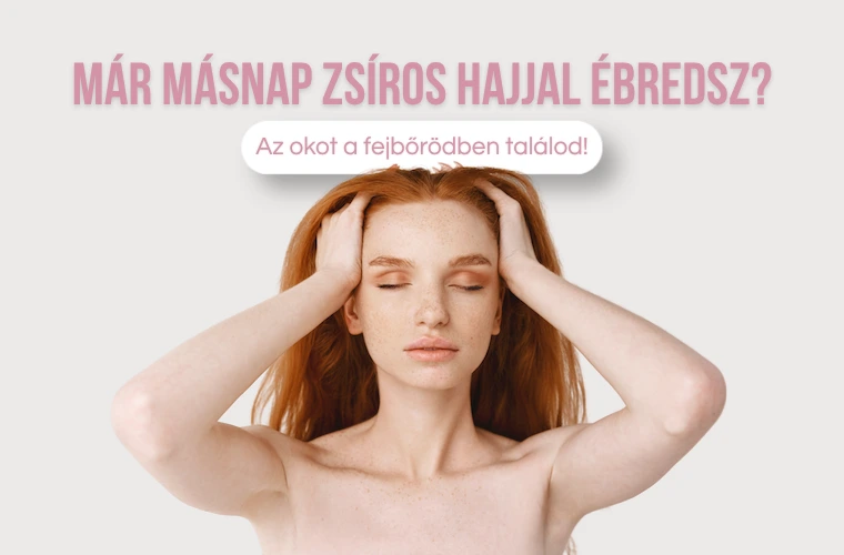 Miért zsírosodik a hajad már másnap? – A valódi ok a fejbőrödben keresendő
